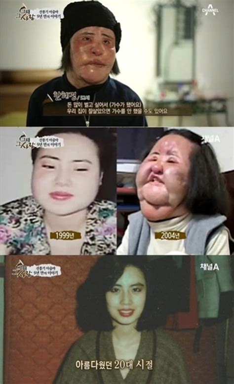 선풍기 아줌마 근황방송 후 9년고통은 여전 이투데이