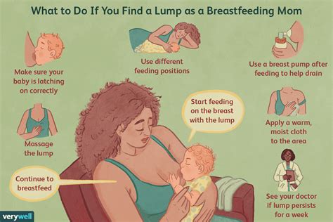 Breastfeeding And Breast Lumps