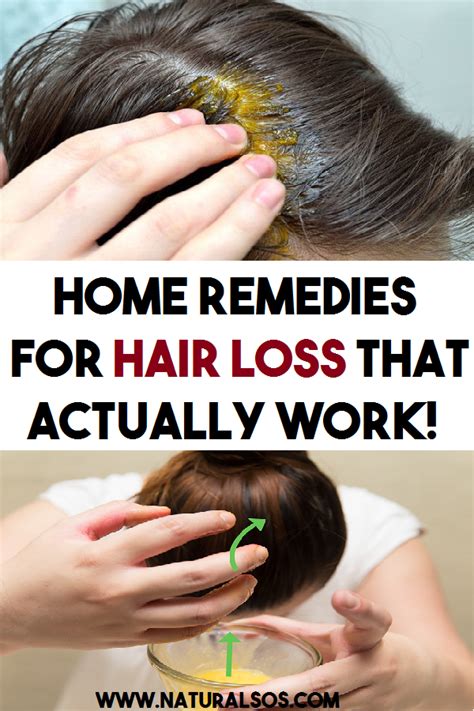 Hair Loss Front Of Head Female Remedies A Complete Guide The Definitive Guide To Mens Hairstyles