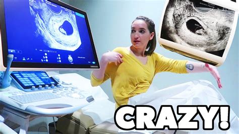First Ultrasound 8 Weeks Pregnant 👶🏻 Youtube