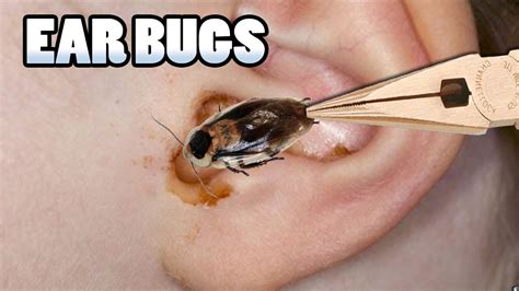 Most Popular Bugs In Ears Bug Removal And Prevention Youtube