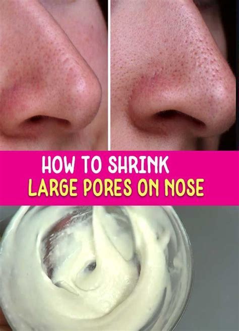 Skin Care Advice That Will Help At Any Age Acne On Nose