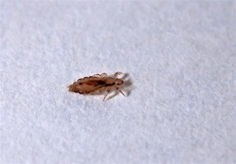 Head lice: Causes, symptoms, and treatments