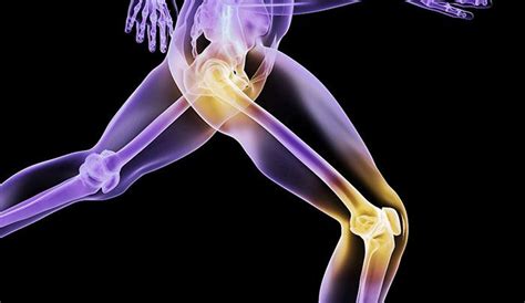 3D Printed Joints Hold Great Promise for Patients Needing ...