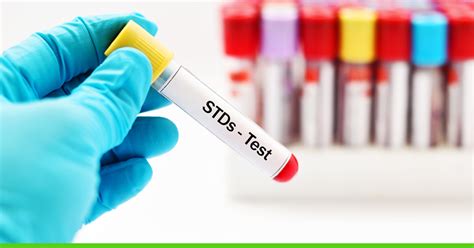 Std Testing A Complete Guide On How To Get Tested For Stds