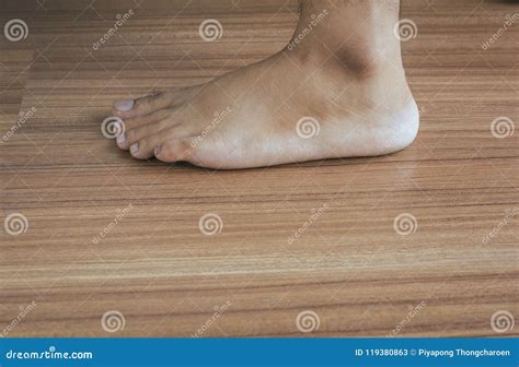 Man Dry Skin Or Pigmentation On Foot With Ankleboneclose Upskin