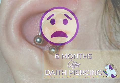 Hopeful Results 6 Months After Daith Piercing For Migraines
