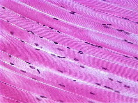 Skeletal Muscle Histology Labeled