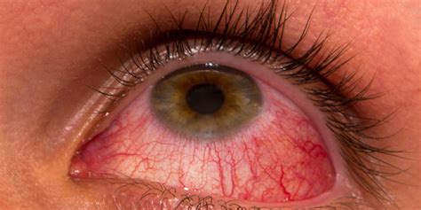 Problemy ze wzrokiem, które powinny zaniepokoić - Zdrowie
