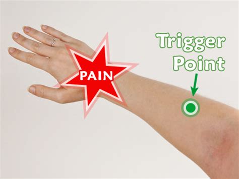 Pressure Point Hand