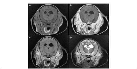 Figure Magnetic Resonance Imaging Study Of The Head Of A A Month Old