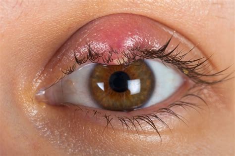 Unam Investiga Bacterias Para Tratar Infecciones En Los Ojos Salud180