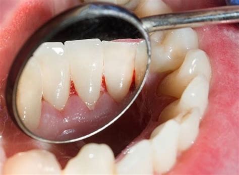 Simple Science: How to Make a Volcano with Kids