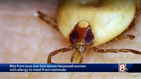 Bite From Lone Star Tick Leaves Harpswell Woman With Allergy To Mammal Meat