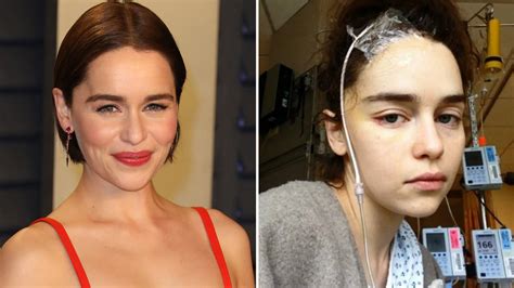 Game Of Thrones Actress Emilia Clarke Shares Shocking Unseen Photos