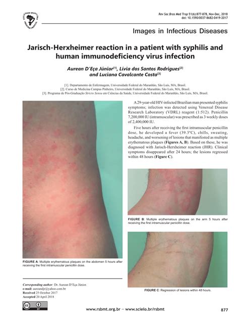 They noticed that in response to treatment, many patients. (PDF) Jarisch-Herxheimer reaction in a patient with ...