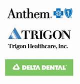 Images of Delta Dental Major Services