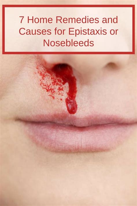 7 Home Remedies And Causes For Epistaxis Or Nosebleeds Home Remedies