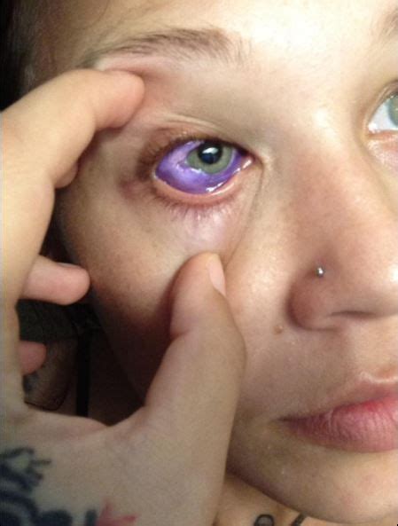 Top 75 Eye Tattoo Gone Wrong Latest Esthdonghoadian