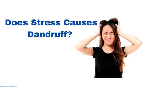 Can Stress Cause Dandruff Advice Permanent Solution