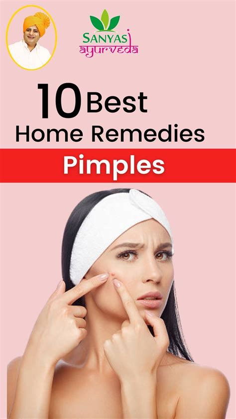 10 Best Home Remedies For Pimples Artofit