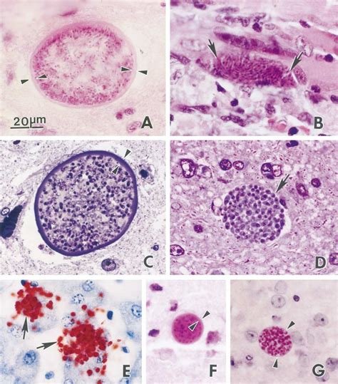 Neospora Caninum Af Tachyzoites And Tissue Cysts In Histologic
