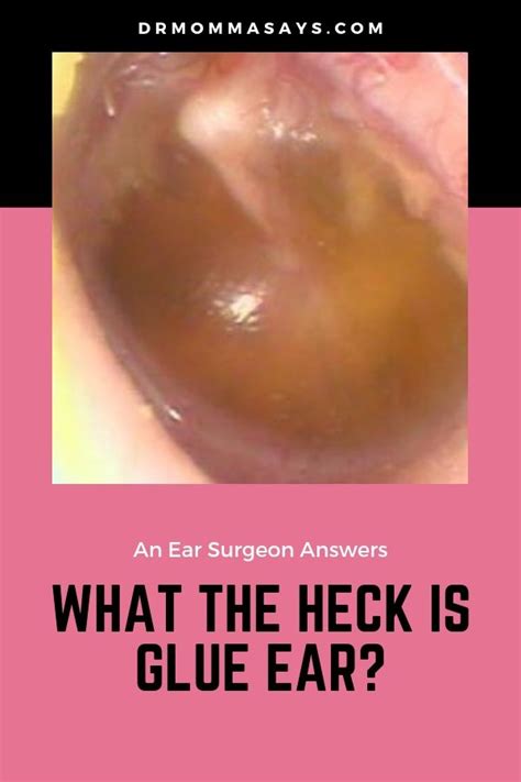 What The HECK Is Glue Ear Dr Momma Says Mom Advice Fluid In Ears