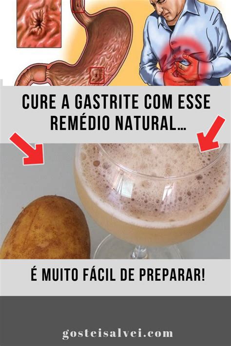 Cure a Gastrite Esse Remédio Natural É Muito Fácil de Preparar