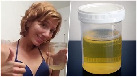 Us Woman Cures Acne By Applying Pee On Face Heres What You Should Know About Urine Therapy