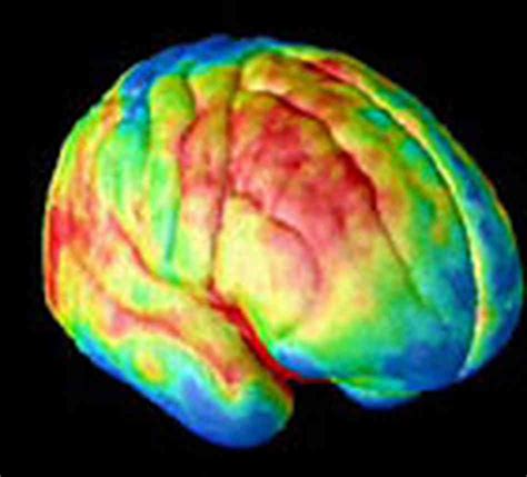 Brain Jack Image Brain Imaging