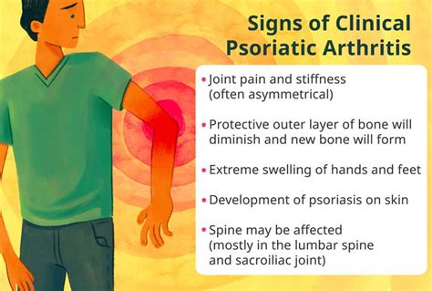 Clinical Features Of Psoriatic Arthritis
