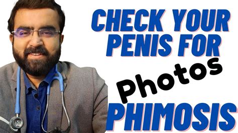 How To Identify Whether You Have Phimosis Or Not Guide With Photos For Easy Checkup Of Penis