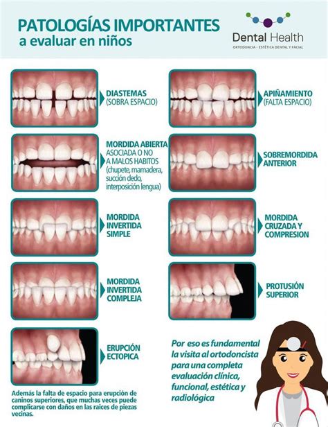 Anomalías Dentomaxilares Niños Por Dental Health Anomalías Dental
