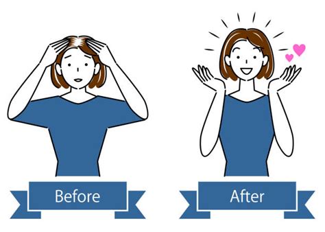 Thinning Hair Illustrations Royalty Free Vector Graphics And Clip Art
