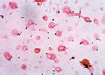 Overview of industries affected by listeria. Diagnostik | Universitätsklinikum Ulm