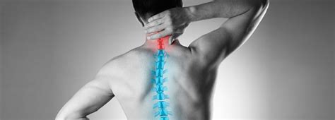 Kyphosis Roundback Of The Spine New Mexico Orthopaedic Associates