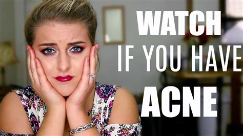 10 Mistakes I Made That Caused Acne Youtube