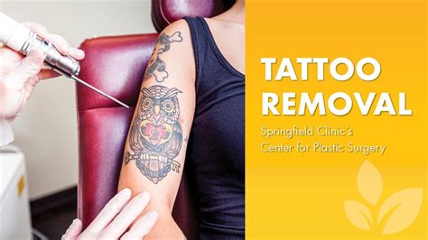 Laser Tattoo Removal Services Youtube
