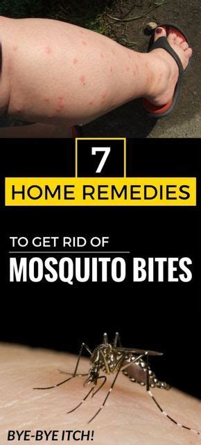 7 Effective Home Remedies To Get Rid Of Mosquito Bites Remedies For