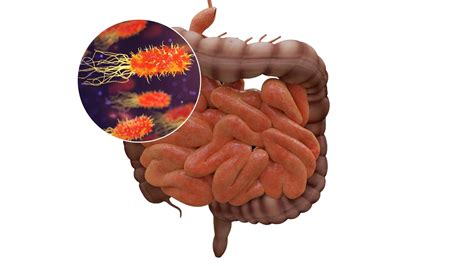 Salud Un Virus Revela C Mo Manipular El Microbioma Intestinal Para