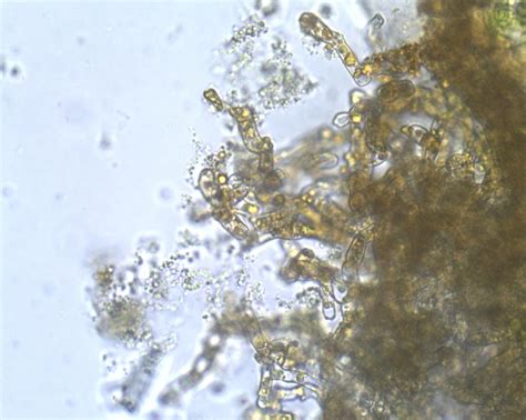 Lophodermium abietis -fungus producing mycelia and... - MICROFUNGI FENNICI
