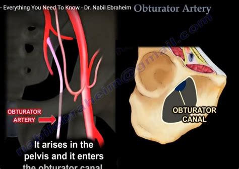Anatomy Of Obturator Artery —