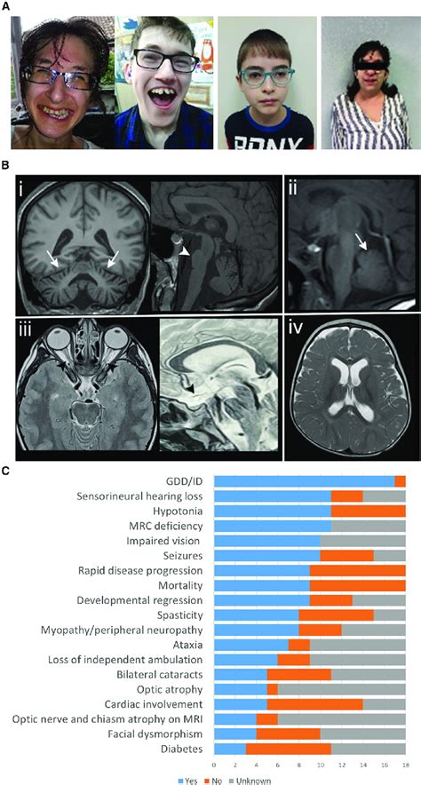 Clinical Features And Neuroimaging Findings Of The Individuals With