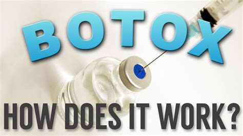 If you are having a good. Botox. How long does it take to work? - YouTube