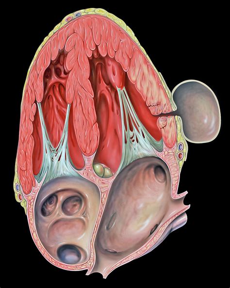 Aneurysms are potentially fatal if they rupture. Pseudoaneurysm - Wikipedia