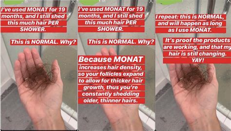Top 48 Image Pictures Of Normal Hair Loss In Shower Vn