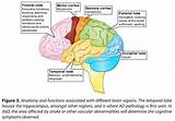 Pictures of Part Of Brain That Affects Balance