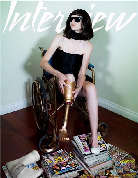 Kylie Jenners Wheelchair Photo Shoot Hits The Fan