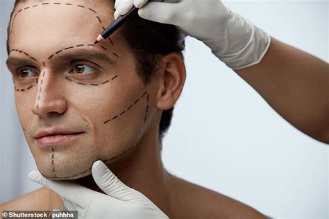 Men Who Have Facial Cosmetic Surgery Are Seen To Be More Attractive And