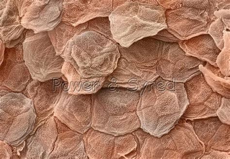 Skin Under Fingernails Microscope Micropedia